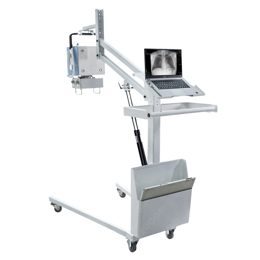 Китайский производитель портат – обзор и цена Photography X Ray